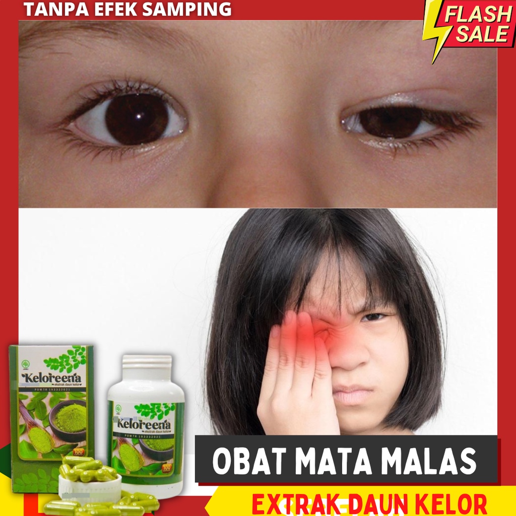 Obat Amblyopia Kelainan Pada Mata OBAT MATA MALAS SEBELAH KELORENA OBAT MATA MALAS PADA ANAK - Obat 