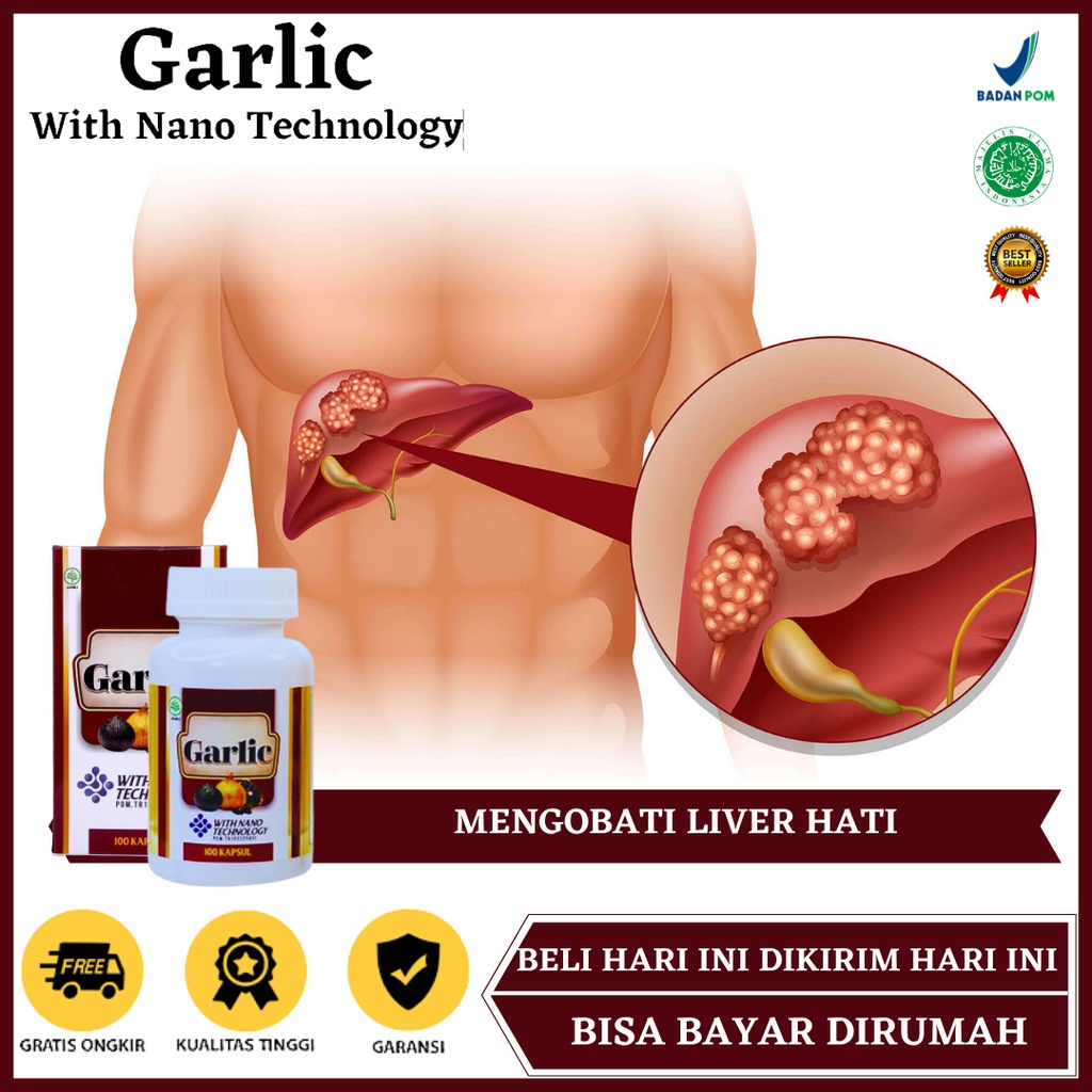 Obat Liver, Obat Liver Hati, Obat Liver Perut Bengkak, Obat Liver Hepatitis, Obat Liver Bengkak, Oba