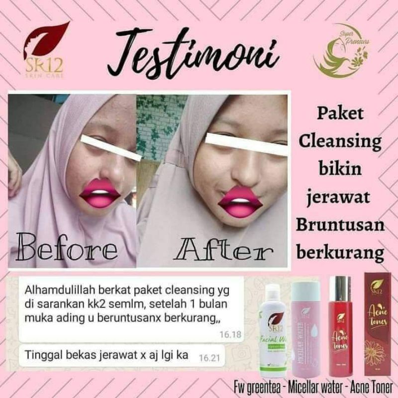 SR12 PAKET DEEP CLEANSING / DOUBLE CLEANSING SR12 / PEMBERSIH KULIT WAJAH MAXIMAL