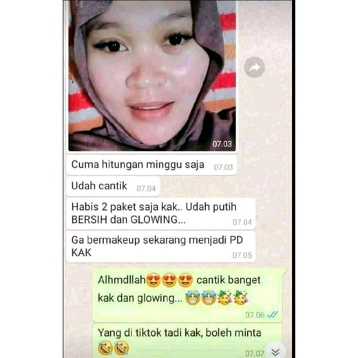 [ BPOM ]Paket Acne Zayora Skincare BPOM Perawatan Wajah Berjerawat Aman Untuk Bumil &amp; Busui/ Menghilangkan Jerawat dan Brutusan Serta Noda Hitam