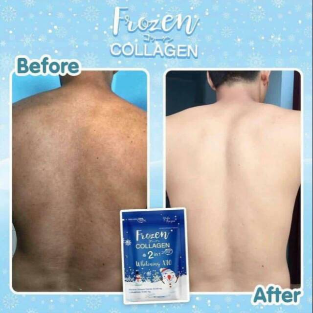Frozen Collagen 2 in 1 Whitening 10x