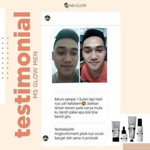 MS GLOW MEN Msglow For Men Paket Perawatan Wajah Pria Skincare Wajah Facial Wash Serum Cream Cowok