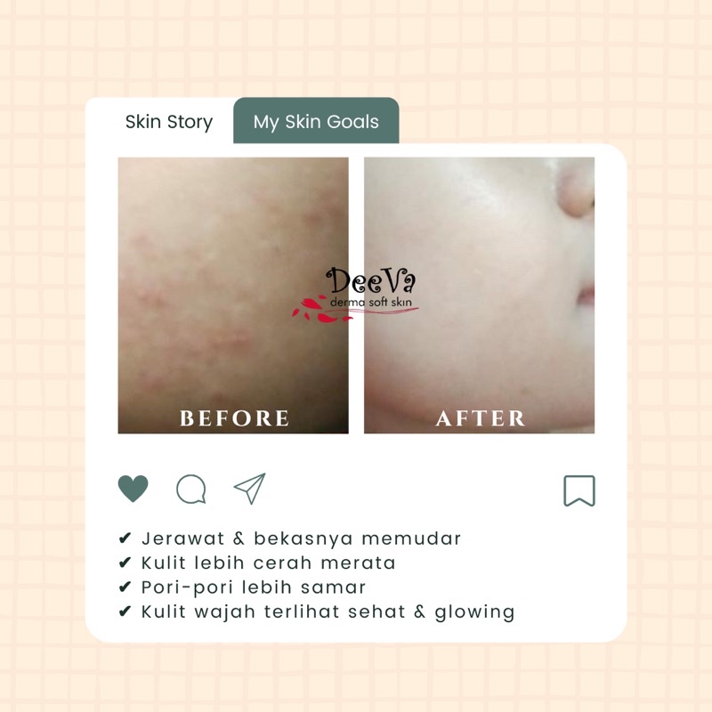 DeeVa Derma Soft Skin - Luminous Glow Facial Wash (facial foam / sabun cuci wajah / skincare bpom)-4