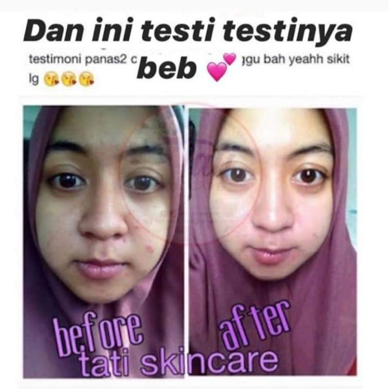 Bisa Cod Tati Skincare Original Shopee Indonesia