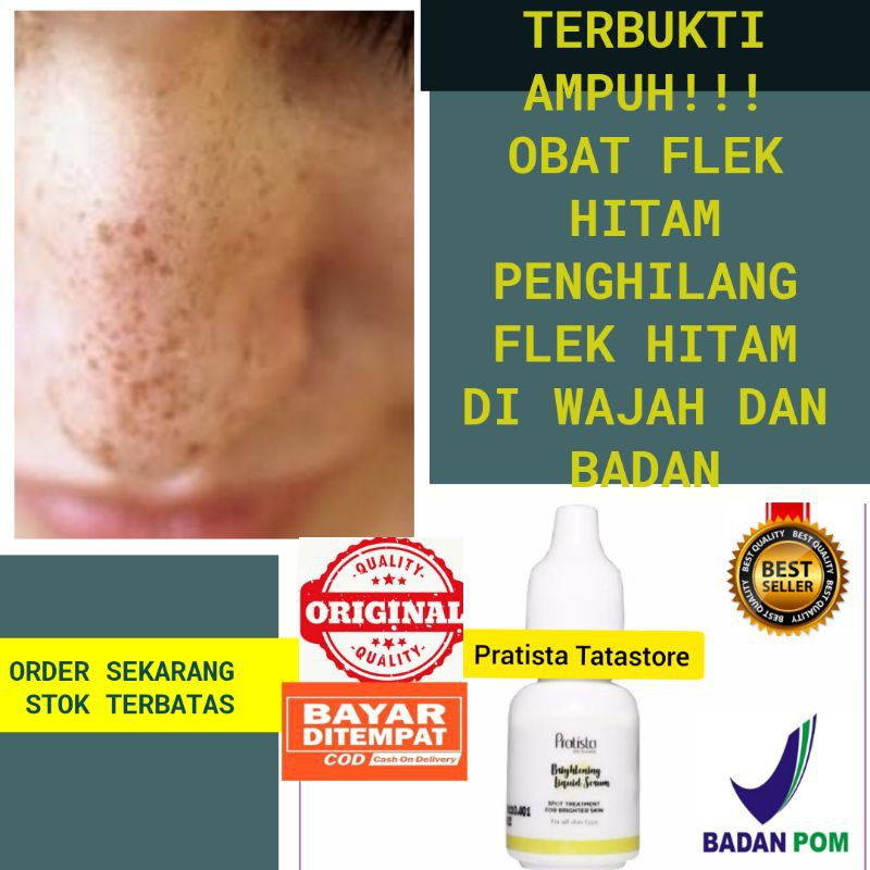 Obat Flek Hitam Penghilang Flek Hitam Ampuh Pratista Brightening Liquid Serum Shopee Indonesia