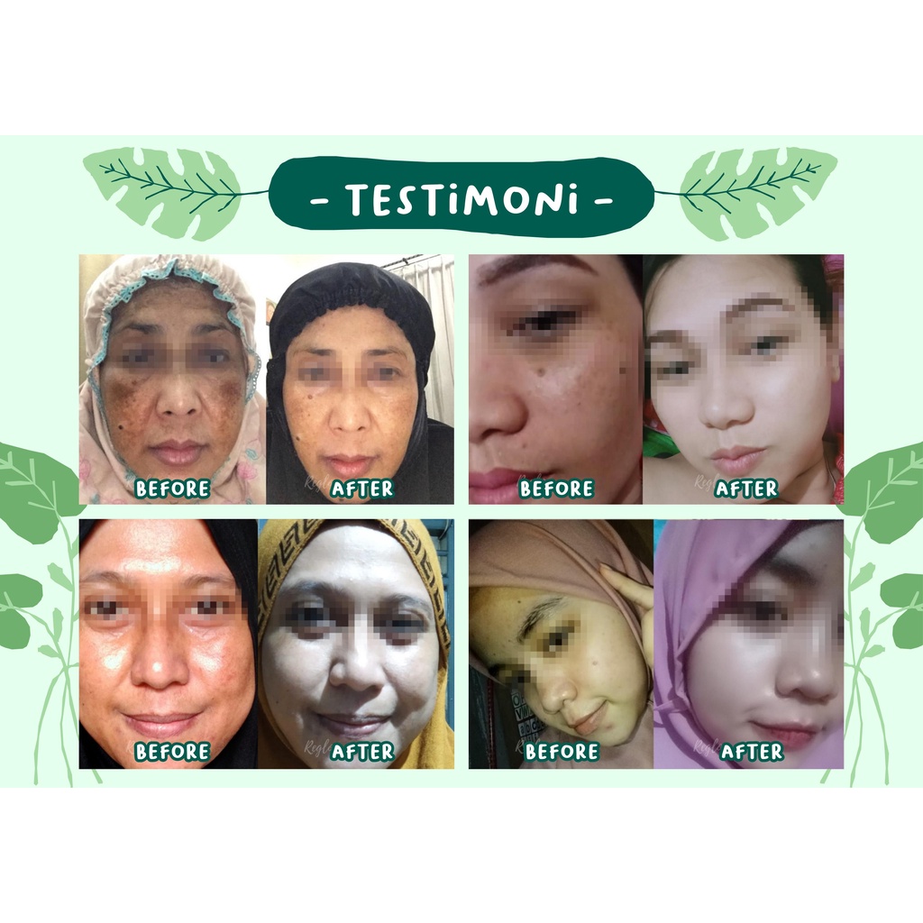 Paket Skincare Glowing Treatment Reglow / Pemutih Pencerah Wajah Free Pouch Premium Termurah-8