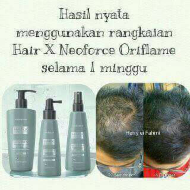 HAIR X NEOFORCE SET / PERAWATAN RAMBUT RONTOK Import swedia