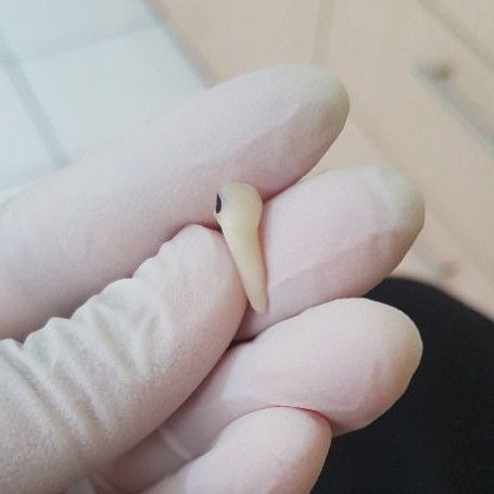 [SULUNG/SUSU] GIGI ASLI MANUSIA SERI / INCISIVUS SUSU / SULUNG / ANAK UNTUK PRAKTIKUM