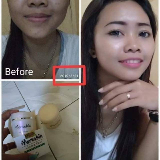 

Perawatan herbal
