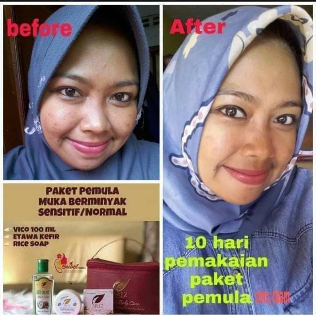PAKET PEMULA SR12