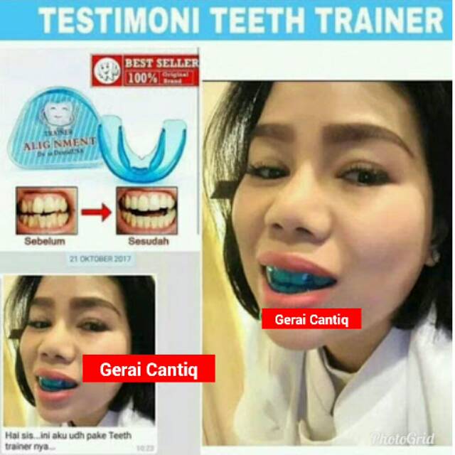 TRAINER ALIGNMENT - SILICONE ORTHODENTIC RETAINER / TEETH TRAINER ORIGINAL - PERATA GIGI