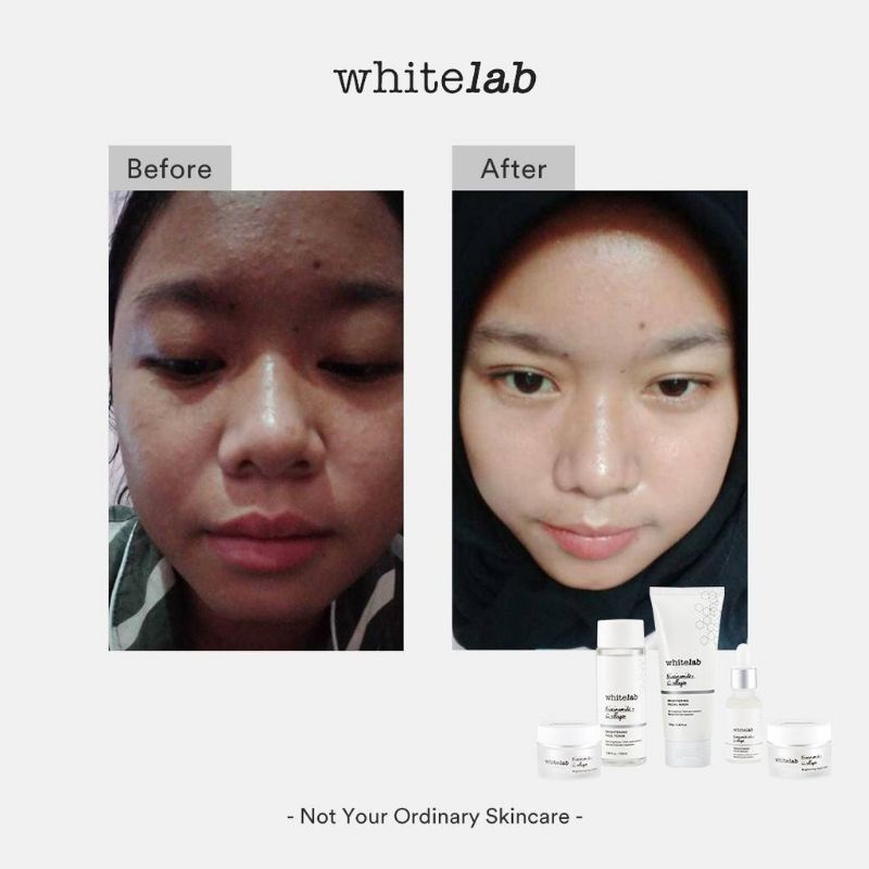 Whitelab Brightening Paket Wajah