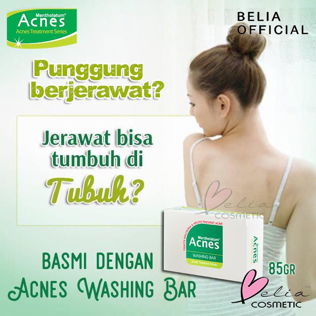 ❤ BELIA ❤ Acnes Creamy Wash Foaming Washing Bar 50g 80g 100g | Sabun cuci muka anti jerawat badan | BPOM