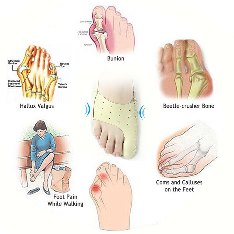 Alat Terapi Pelurus Jari Jempol Kaki Korektor Jari Jempol Kaki