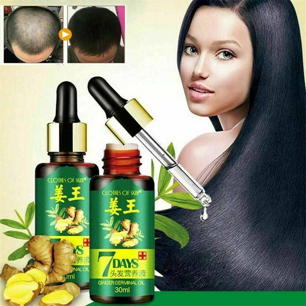 SERUM RAMBUT ANTI BOTAK Clothes of Skin Ginger Germinal Oil 30 ml