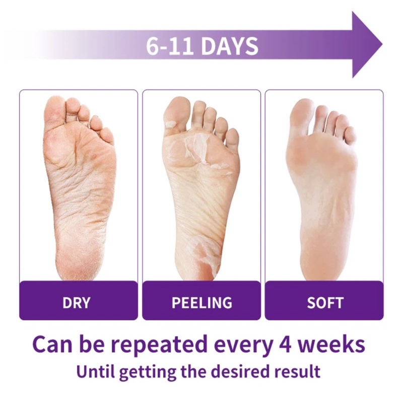 TIROS LAVENDER EXFLOLIATING FOOT MASK