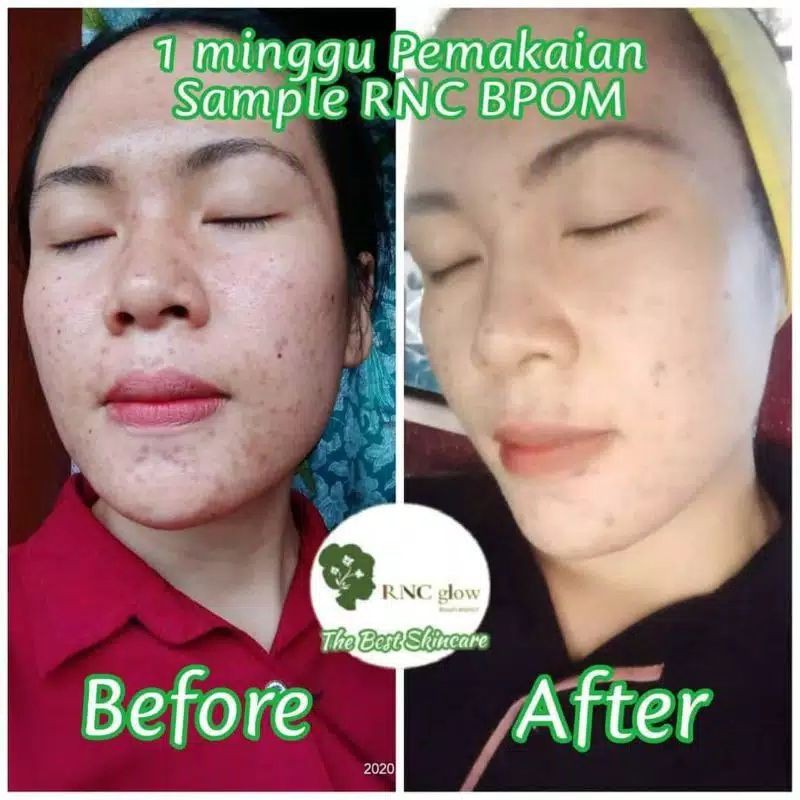 RNC Glow ORIGINALL BPOM