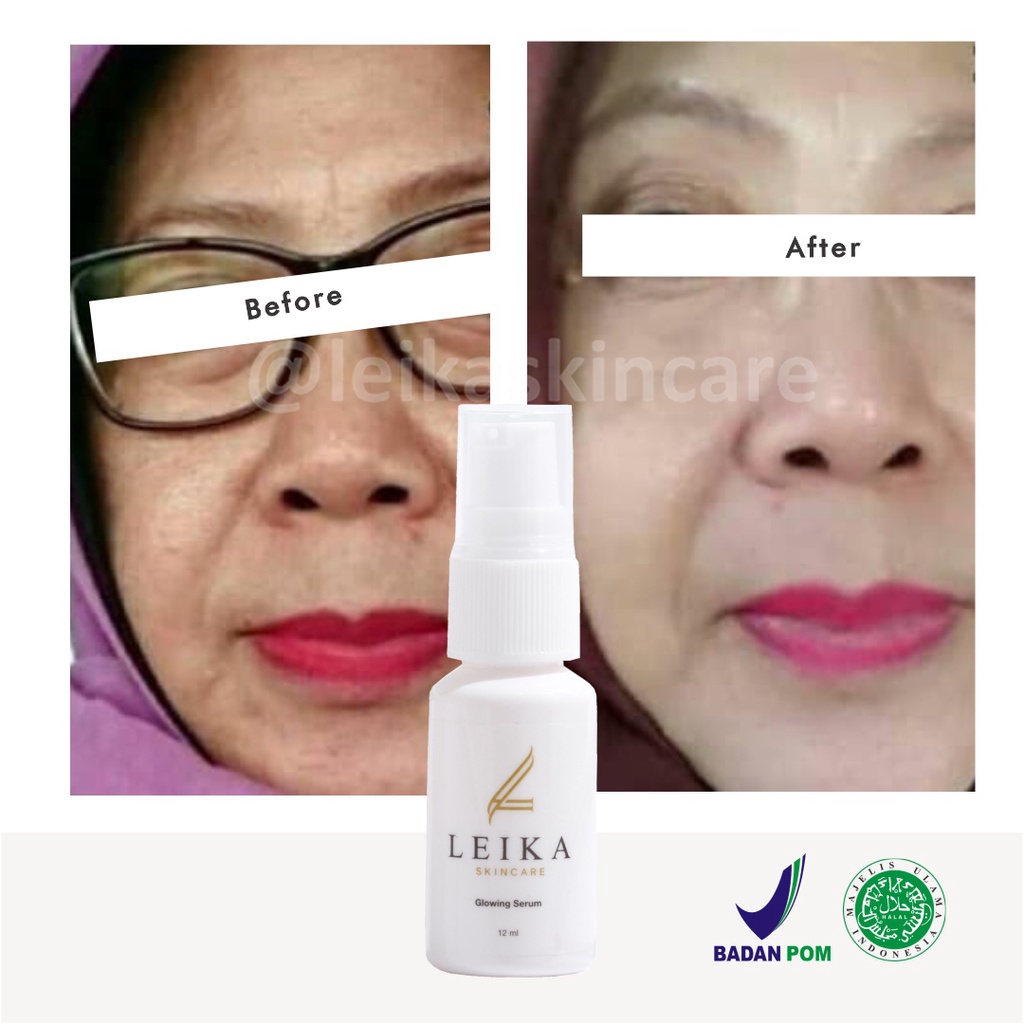 Menakjubkan! Serum Wajah Anti Penuaan Dini Serum Anti Aging Whitening Terbaik BPOM Serum Penghilang Kulit Keriput di Kulit Wajah Ampuh Glowing Serum Leika Skincare 12ml Halal MUI Resmi BPOM