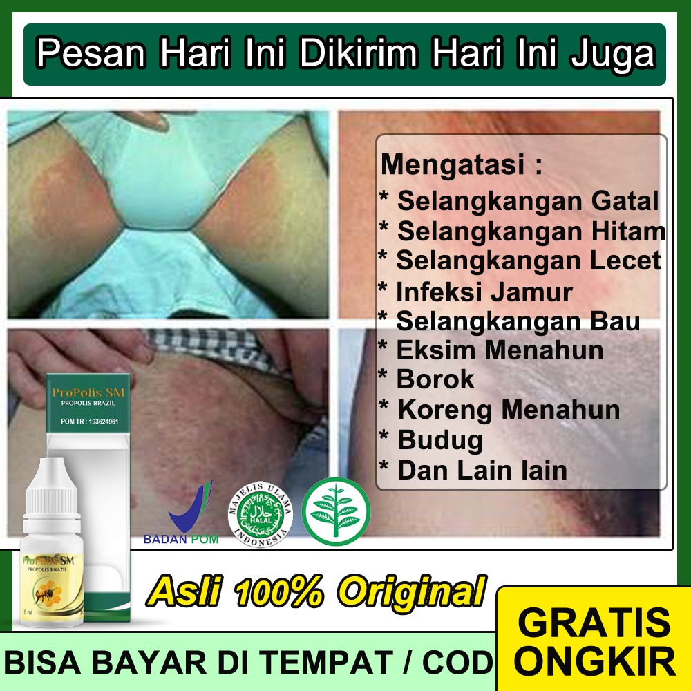 

Obat Selangkangan Hitam Dan Gatal Jamur Selangkangan Herbal Walatra Propolis SM Brazil Asli 100% ORI