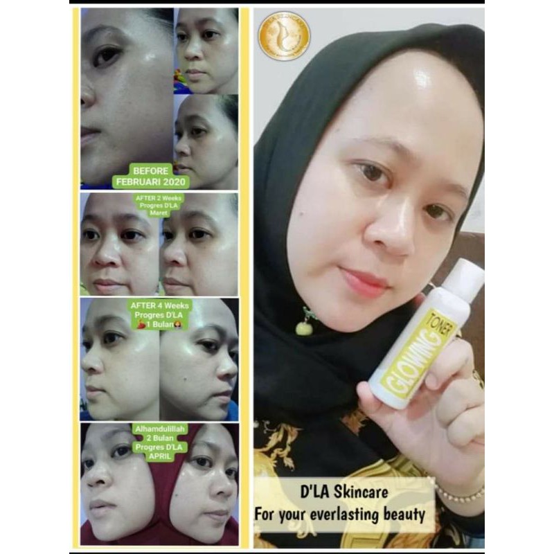 toner glowing D'La skincare