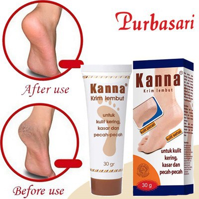 Purbasari Kanna Cream Tube 30 Gr