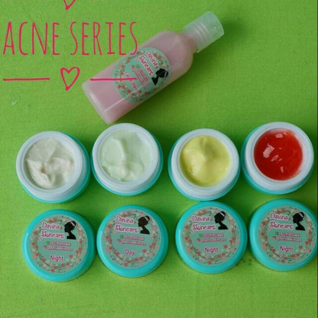 Skincare acnegseries Davina skincare