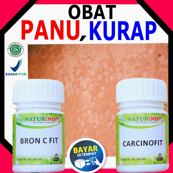 

OBAT PANU MENAHUN JAMUR KULIT KADAS KURAP CACAR AIR PALING AMPUH HERBAL ALAMI NATURINDO BISA COD