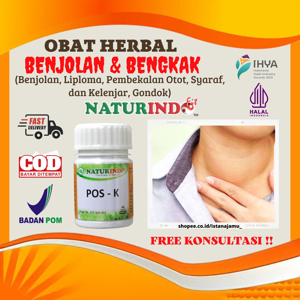 Jual Obat Herbal Benjolan di Leher Bengkak Kelenjar Tiroid Kelenjar