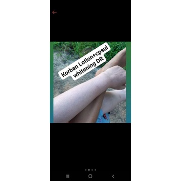 KAPSUL PEMUTIH VITAMIN KULIT VIRAL