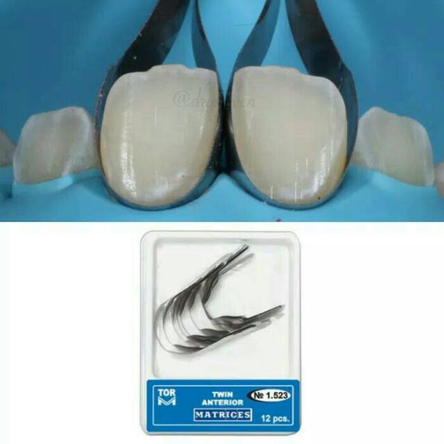 Alice dental // twin anterior matrix TOR original / ori / matriks proximal gigi depan