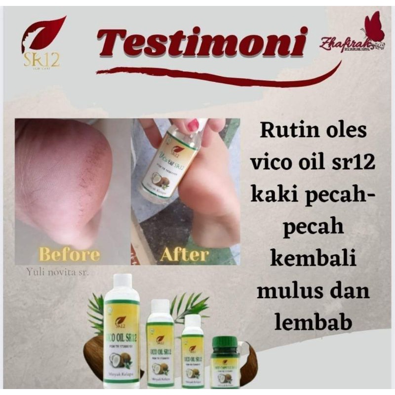 Obat Kaki Pecah dan Kering - Penghalus Tumit Kaki - Minyak Kaki Pecah2 Ampuh