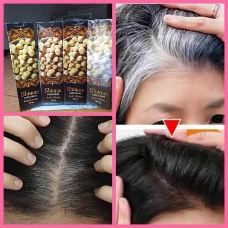 SERUM ANTI UBAN SHANAS TERLARIIIS BPOM