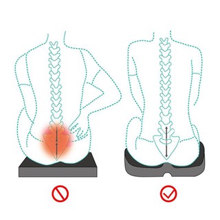 Alas Duduk Terapi Orthopedic Coccyx Sciatica Punggung Alas Duduk Terapi Orthopedic Coccyx Sciatica Punggung