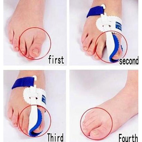 PELURUS JEMPOL KAKI, HALLUX VALGUS. SPLINT , BUNION PAD, NIGHT SPLINT