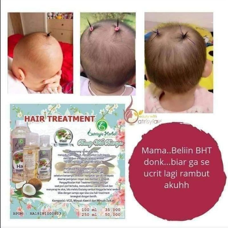 Baby hair treatment/ Penumbuh rambut anak/melebatkan rambut/menghitamkan rambut bahan alami bpom