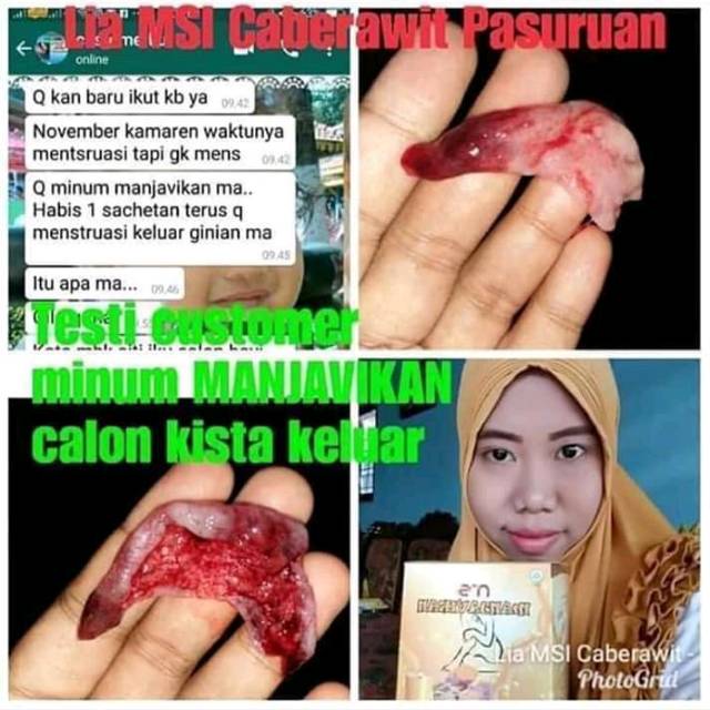 

Jamu wanita terlaris