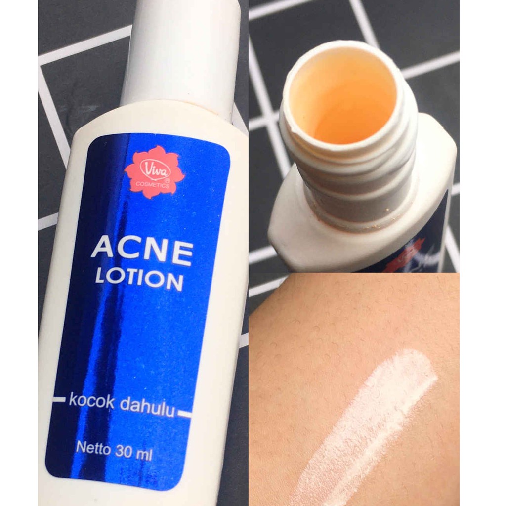 [Original] Viva Acne Lotion Ekfektif Menghilangkan Jerawat Obat Jerawat 30 ml