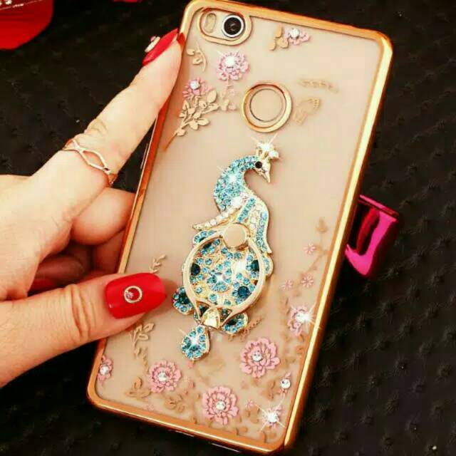 Casing Xiomi Redmi 4X Softcase Diamond Ring Series