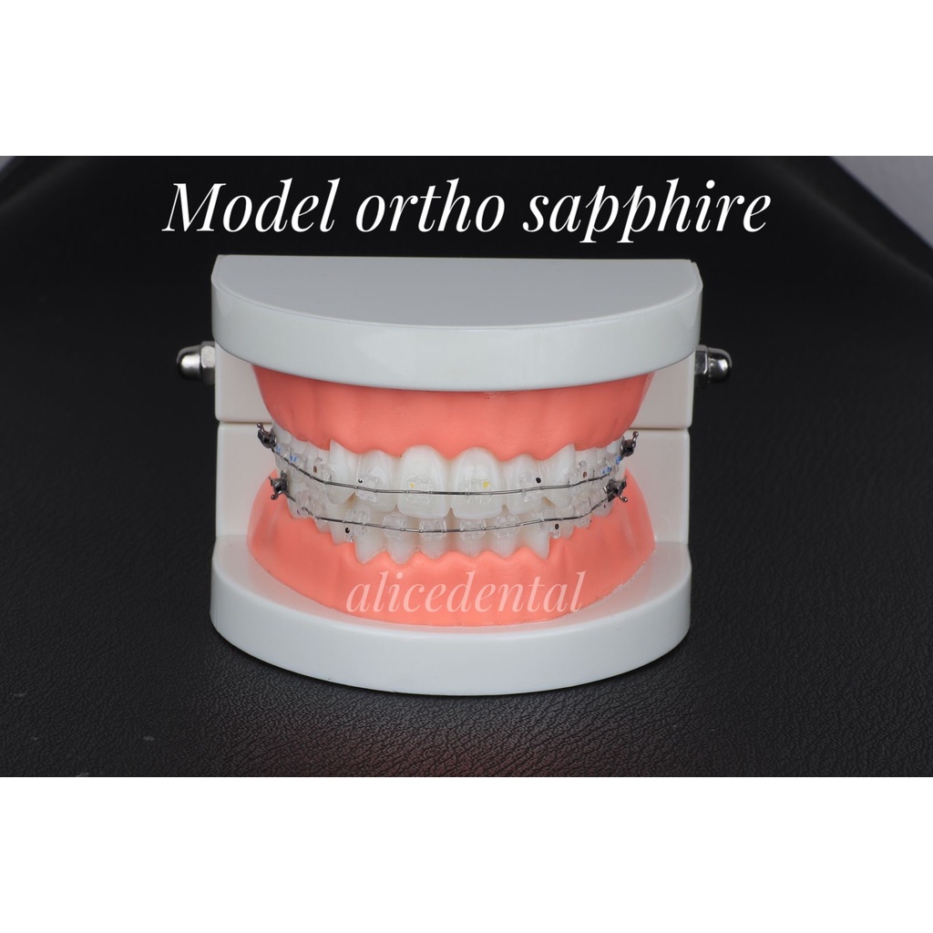 Model gigi ortho CERAMIC SAPHIRE SELF LIGATING sapphire dental study model orthodontic phantom studi