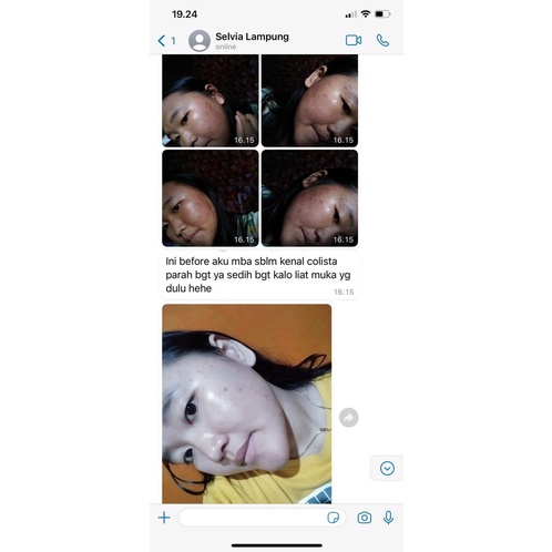 Paket Acne Colista Skin Care BPOM-1