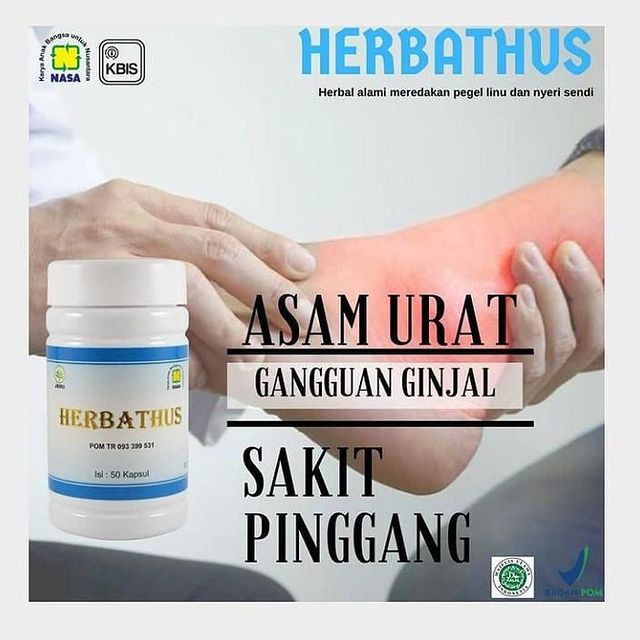 

HERBATHUS NASA Obat herbal asam urat, pegel linu dan nyeri sendi serta batu ginjal