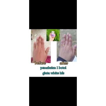 pemutih kulit gluta white kfs