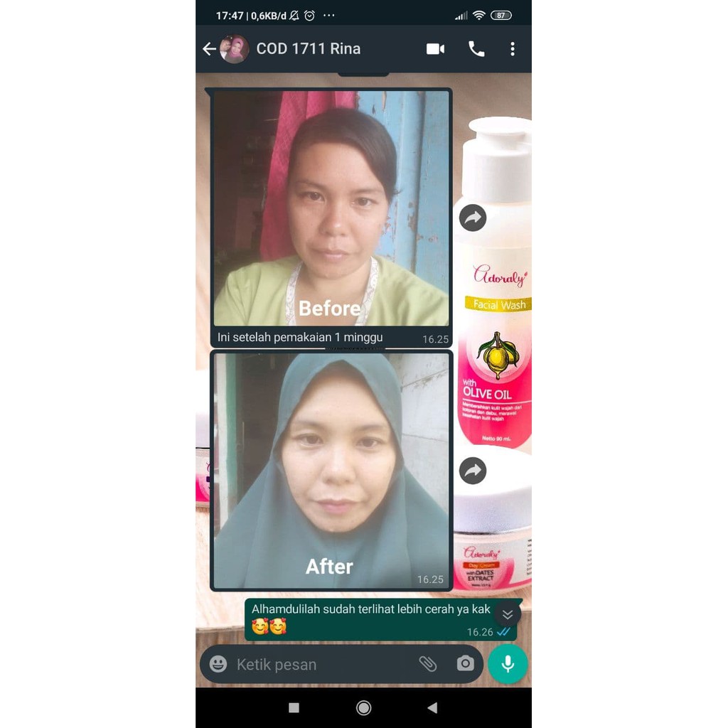 [1 PAKET] ADORALY (Bonus TUMBLER dan POUCH) -SKINCARE BPOM, GLOWING, ANTI JERAWAT, FLEX HITAM, KUSAM-2