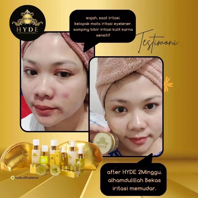 HYDE BEAUTY SKINCARE PAKET GLOWING PEMUTIH WAJAH PENGHILANG FLEK JERAWAT ORIGINAL BPOM HYDE SKINCARE ORIGINAL