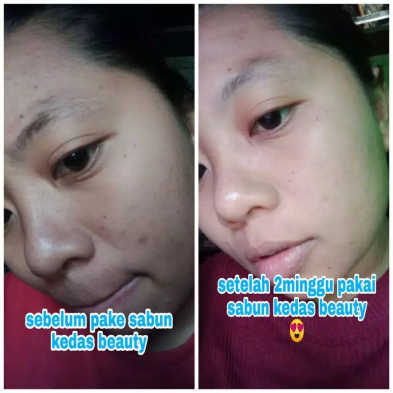 Medan Termurah Sabun Viral Segudang manfaat BPOM Sabun kedas beauty