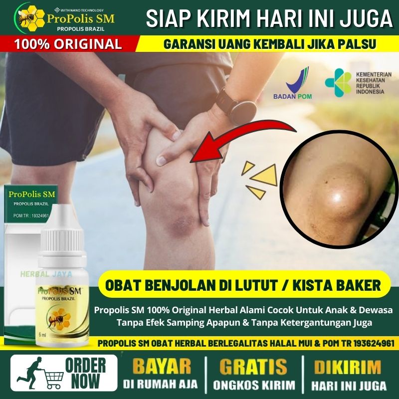 Obat Herbal Benjolan di Lutut, Penghilang Benjolan Abnormal di Belakang Lutut, Obat Penyakit Kista B