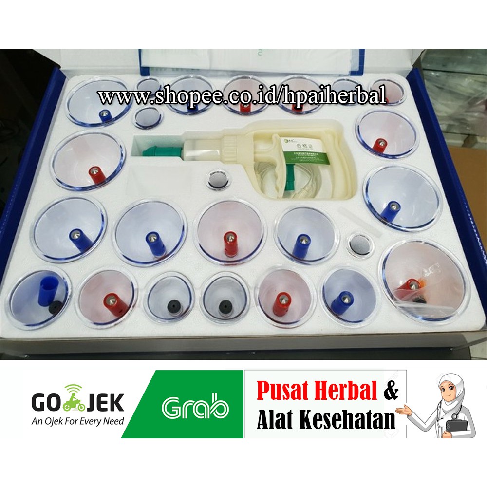 Alat Bekam Kangzhu Isi 24 Kop Alat Bekam isi 24 Kop