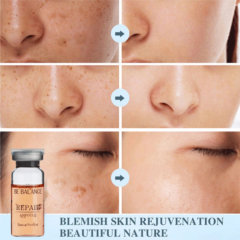 BE BALANCE Serum Wajah REPAIR Serum MTS REPAIR /ALA / BRIGHTENING /HYDRO