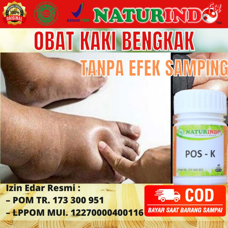 Obat Herbal Kaki Bengkak Pembengkakan Pada Tubuh  Saraf Penyumbatan Darah Ginjal Jantung Liver Terkilir Asam Urat Memar Kelenjar Tiroid Benjolan