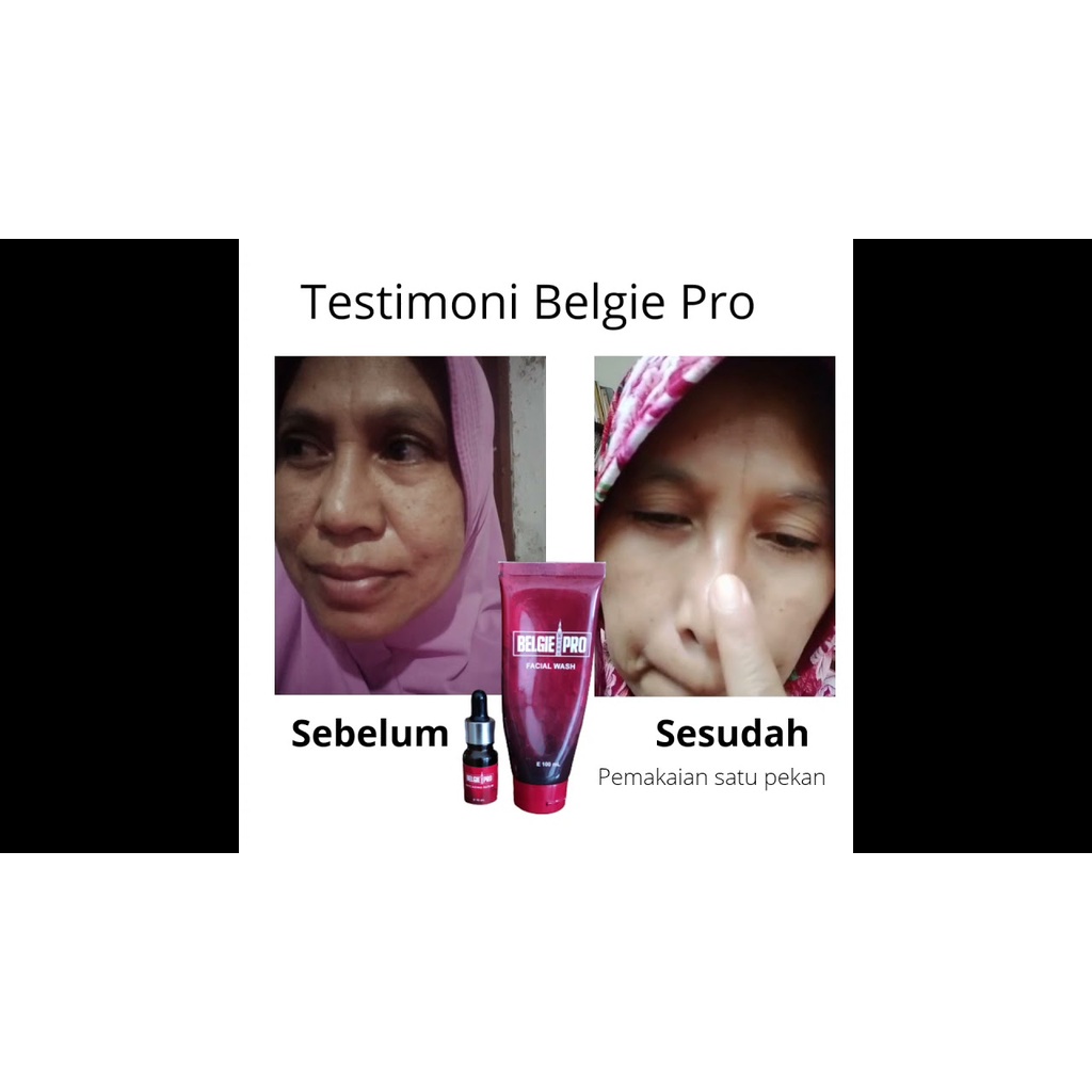 Belgie Pro Anti Aging Serum Serum Wajah Serum Anti Penuaan By Ippho Santosa Isi 10ml